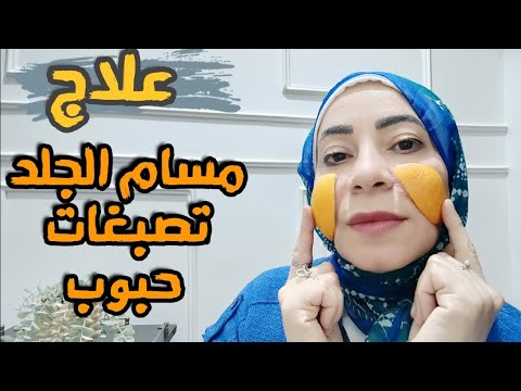 مسام البشرة وتصبغات وحبوب الوجه 😥 علاج مشاكل البشرة الدهنية