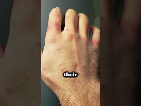 World's Most Dangerous Ant's! ?