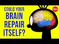 Neurogenesis and Brain Repair Concepts