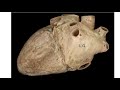 Heart Anatomy and Function Assessment
