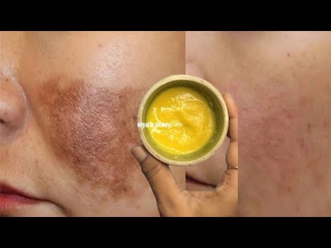 रात में इसे 2 मिनट लगा लो चेहरे को सोने सा निखार देगा, glowing skin, remove wrinkles, fairness