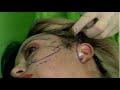 Exploring the Art of Orlan
