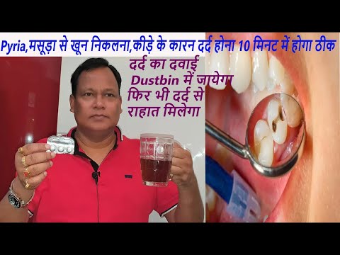 दर्द का दवाई Dustbin में जाएगा ,Pyria,कीड़ेके कारन दर्द होना,मसूड़ा से खून निकलना 10 मिनट में होगा ठीक