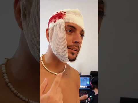 CORTE con NAVAJA SALE MAL...🩸☠️ #tiktok #youtube #memes #shorts @Coscu