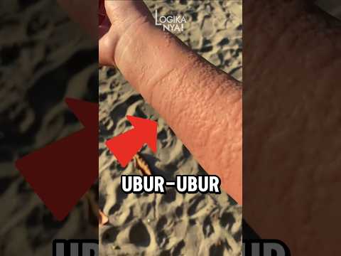 VIRAL!! Jika kalian tersengat Ubur-Ubur, Jangan PANIK😱‼️ #shorts