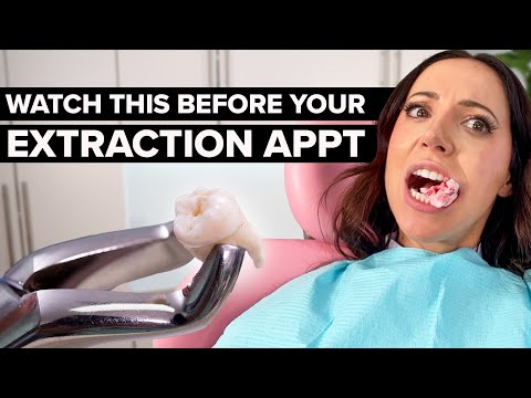 Getting a Tooth Pulled? WATCH THIS First!