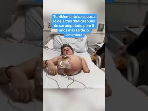 Terriblemente su esposa lo deja tres días después de ser amputado pero 5 años más tarde lo lamentara