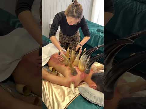 Son Thinks Nails Pulled From Dadโs Back #shorts