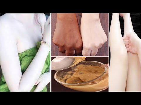 मुल्तानी मिट्टी से मिनटों में साफ करें हाथ, पैर - How to Clean Tan on Hands or Feet - Fair Skin Tips