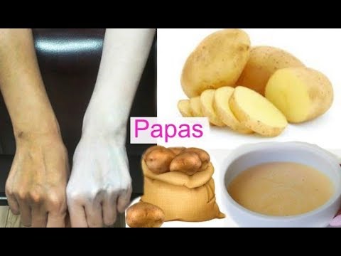 Blanquea Tu Piel en 15 Minutos Con Patata 🥔 Aclara Tu Piel y Elimina Manchas .fashionbycarol