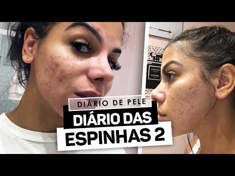 DIÁRIO DAS ESPINHAS 2 - TIRANDO MANCHAS