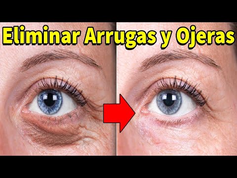 Haz Esto Todas Las Noches, Las Arrugas Y Las Ojeras Desaparecerán