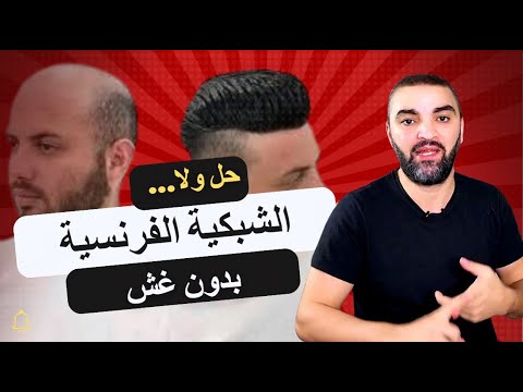 الشبكية الفرنسية لاخفاء الصلع حلم يتحقق ام خدعة تسويقية ؟