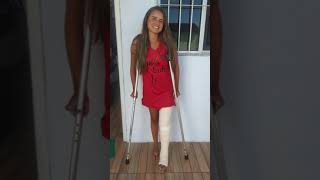 Broken Leg LONG LEG CAST SEXY WOMAN #legcast