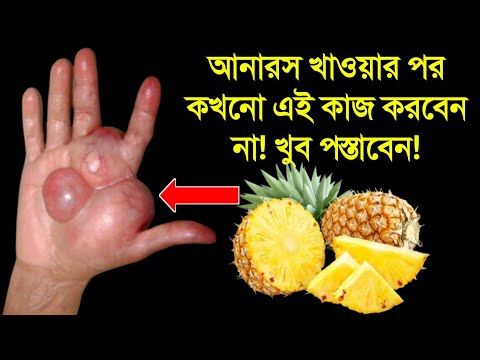 আনারস খাওয়ার আগে থামুন! || আনারস খেয়ে জীবন শেষ  না করতে চাইলে দেখুন! || আনারস খেলে কি হয়?
