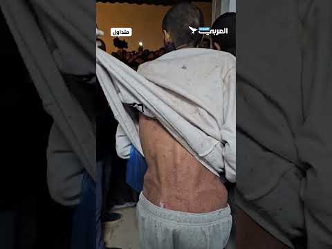 #شاهد | بجسد هزيل وأمراض جلدية.. أسير محرر يكشف معاناة الأسرى الفلسطينيين في سجون الاحتلال