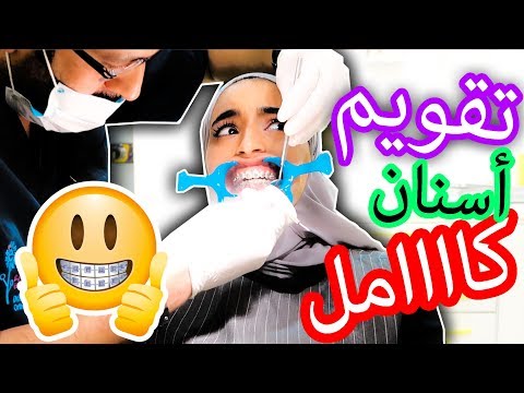 شلون تخلي تقويم الاسنان ما يعورك ؟ تعالوا شوفوا!! 😍 - MY BRACES