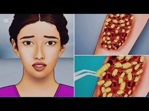 animation 《ASMR》Back treatment /Deep cleaning