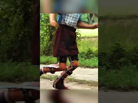 هذا الولد من طفل معااق إلى أقوى لاعب كرة قدم 💪🏈 #shorts #viral