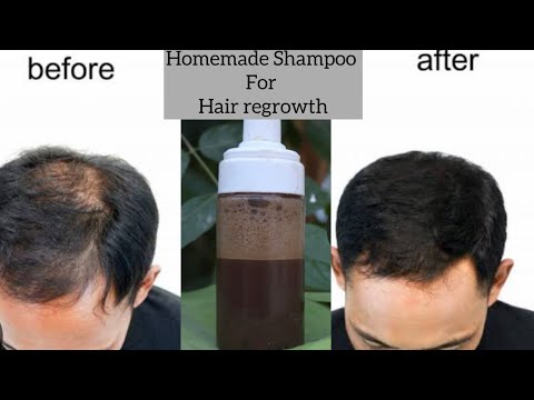 घर पर बनाए हुए शैम्पू से बालों को करें बहुत लंबा Homemade Shampoo for Hair Regrowth