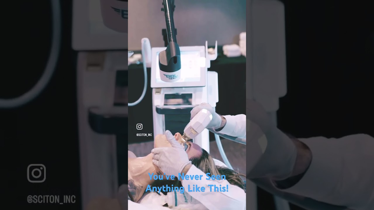 Skincare treatment demonstration with advanced equipment.