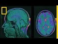 Neuro Preservation Concepts and Procedures