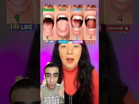 بوقك انهي واحد ما تتكسفش😭😭😂😱