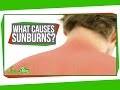 Understanding Sun Exposure and Skin Protection