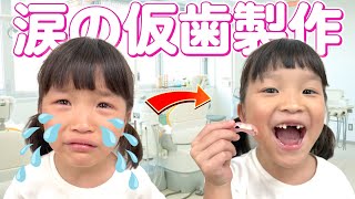 【仮歯作り】歯医者さんはやっぱり怖かった…?!🥹 #ののちゃん