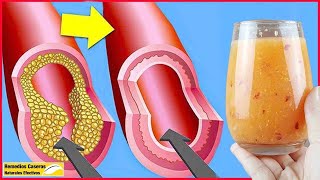 Limpiar Tus Arterias Rápidamente Con Esta Bebida Simple