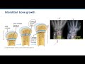 Epiphyseal Plate Zones and Functions