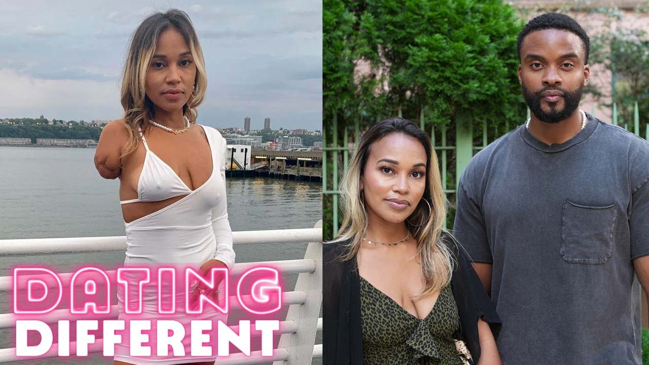 Will my date see past my disability? - dating different