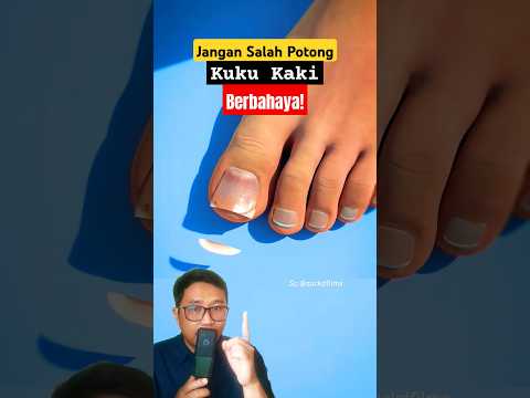 Jangan Salah Potong Kuku Kaki. Berbahaya! #shorts #education #science #nails