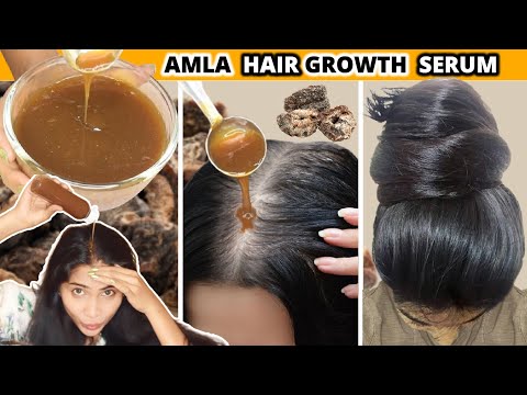 I applied👆🏼Amla Serum on roots for Thick Long Hair Growth in 30 Days-Thinning Hair to Thickest Hair💯