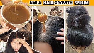 I applied👆🏼Amla Serum on roots for Thick Long Hair Growth in 30 Days-Thinning Hair to Thickest Hair💯
