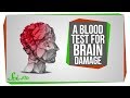 Medical Innovations in Concussion and Eye Disease Diagnosis