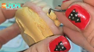 ¿Cómo hacer el encerado para procesado de una prótesis dental parcial?