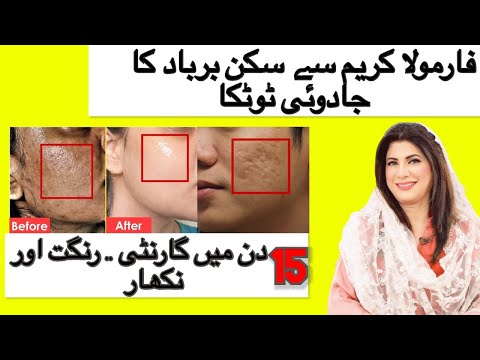 15 DAYS GUARANTEED FAIRNESS, SKIN DAMAGE AND REPAIR | FORMULA CREAM SE SKIN BARBAD KA JADOI TOTKA