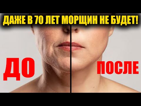 В 70 как в 30! Уничтожает все морщины на лице и шее! Молодое лицо навсегда