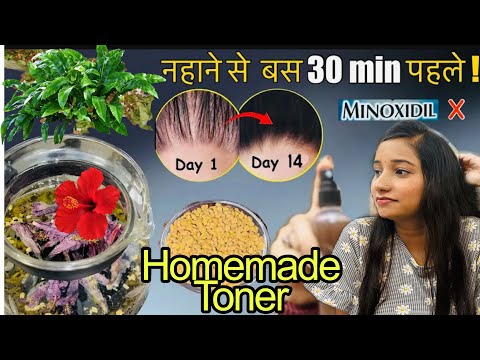 झड़ते बालों को तुरन्त रोके , Homemade Fast Hair Growth Toner !! 🌺