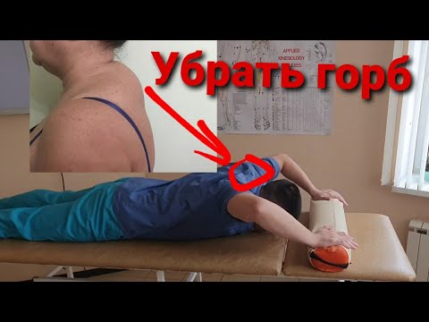 Упражнения для шеи. Как убрать холку на шее, "вдовий горб", увеличить подвижность плечевого сустава