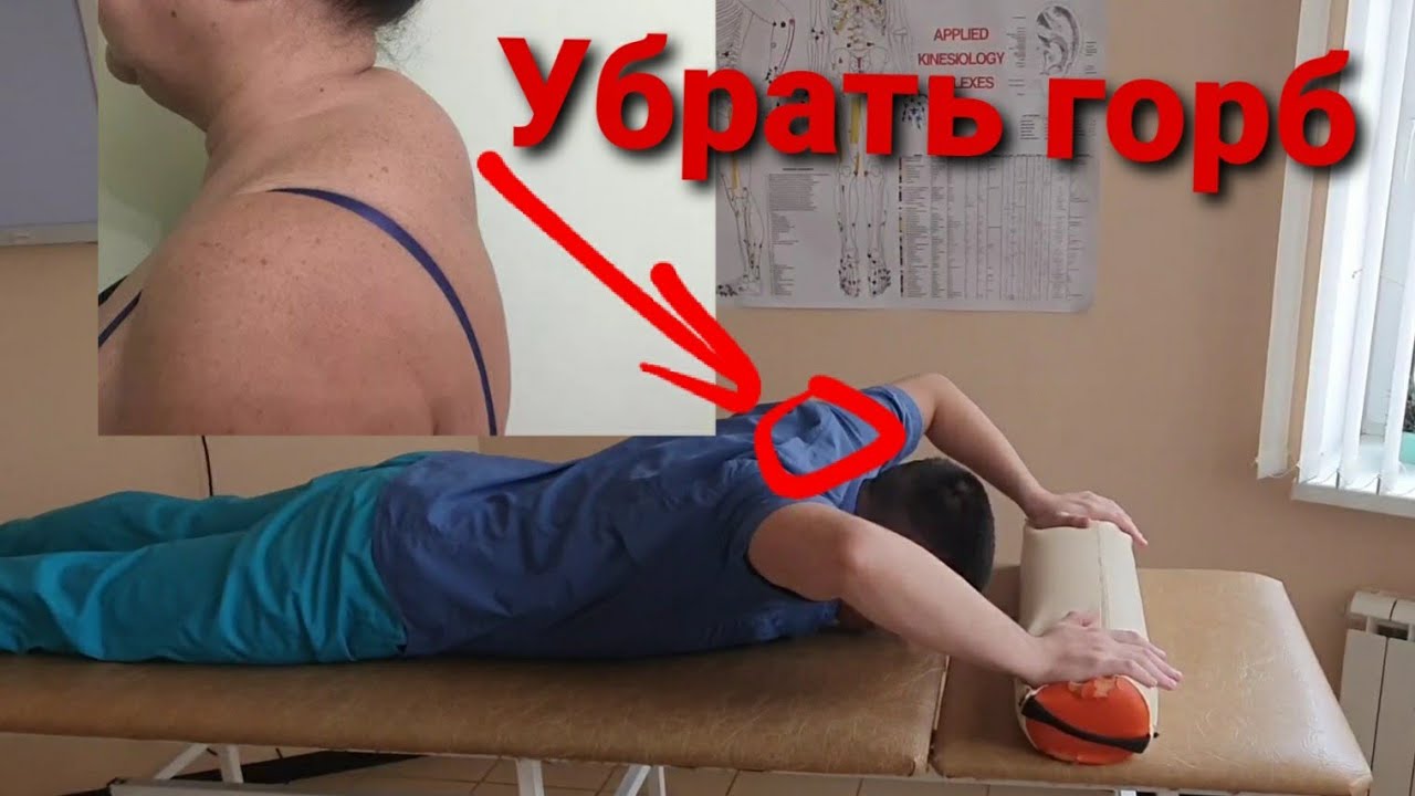 Упражнения для шеи. Как убрать холку на шее, вдовий горб, увеличить подвижность плечевого сустава