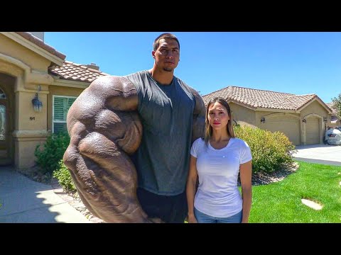 12 People With Bigger Than Normal Body Parts