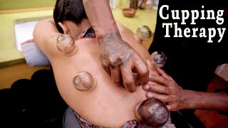 Cupping Therapy Massage by Master Cracker | Deep ASMR for Pain Relief & Relaxation