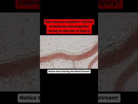 White blood cells leaving the bloodstream (Extravasation)