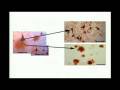 Neurologic Diseases and Cognitive Health