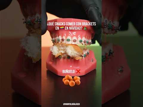 ¿Qué Snacks comer con Brackets en 🇨🇴 en Navidad 🎄- Odontología Láser #Shorts