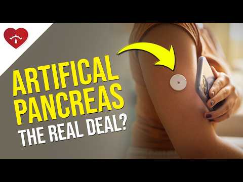 The Artificial Pancreas: YOUR FUTURE For Blood Sugar Control?