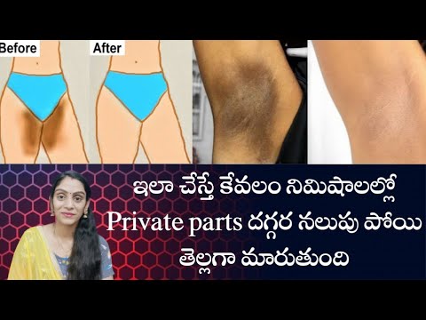 How To Lighten PrivateParts Naturally 100% Works At Home In Telugu@Geeta_Home_remedies