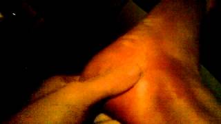 Erythromelalgia flare up at night time. feet on ac for hours :(